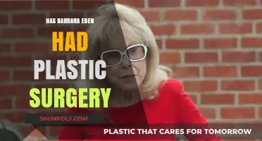 Barbara Eden's Ageless Beauty: Plastic Surgery Rumors Explored