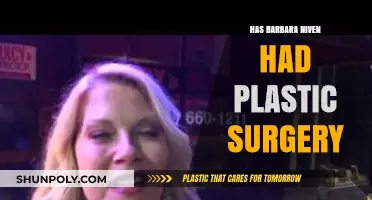 Barbara Niven's Transformation: Plastic Surgery Rumors Explored and Debunked