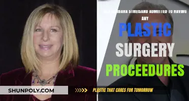Barbara Streisand's Plastic Surgery: What She's Admitted To