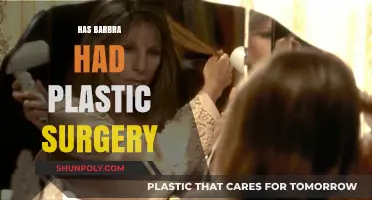 Has Barbra Streisand Had Plastic Surgery? Uncovering the Truth