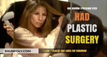 Barbra Streisand's Transformation: Plastic Surgery Speculations and Truths