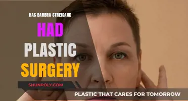 Barbra Streisand's Transformation: Plastic Surgery Rumors and Reality Revealed
