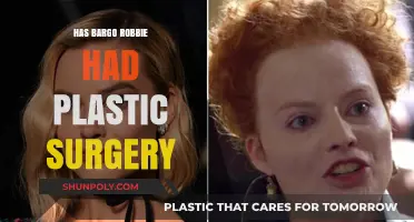 Has Bargo Robbie Undergone Plastic Surgery? Unveiling the Truth