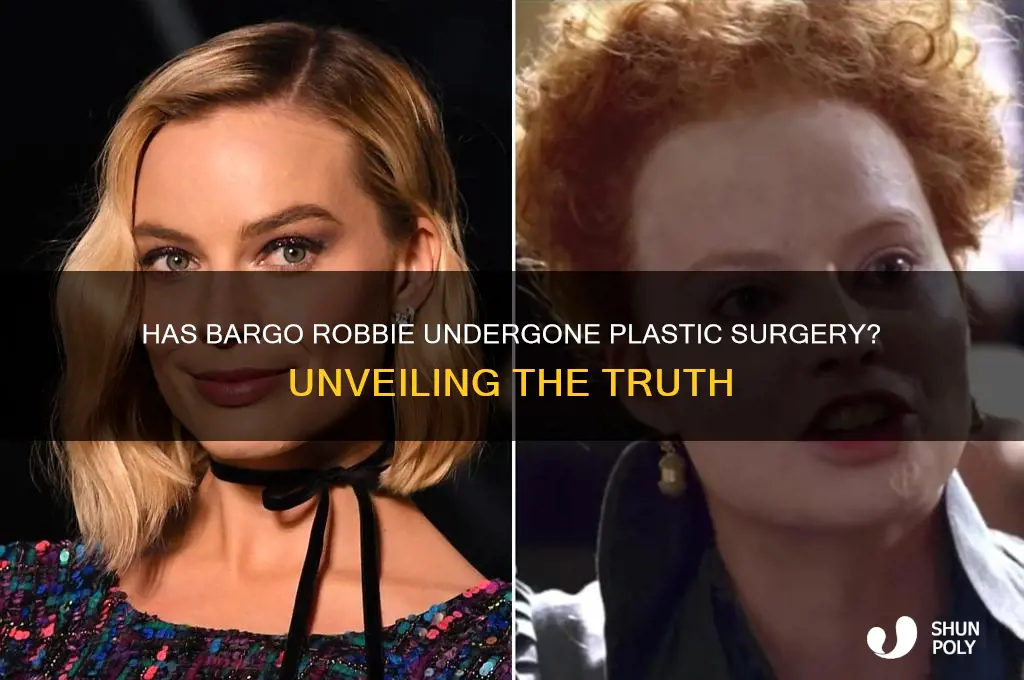has bargo robbie had plastic surgery