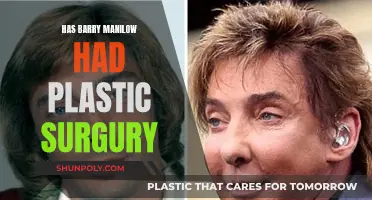 Barry Manilow's Plastic Surgery: What's the Truth?
