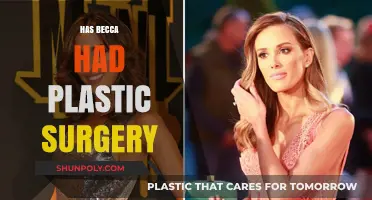 Becca's Transformation: Plastic Surgery Rumors and the Truth Behind Them