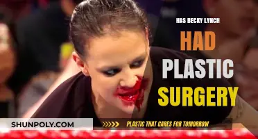 Becky Lynch Plastic Surgery: Fact-Checking the WWE Star's Transformation