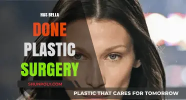 Bella's Transformation: Plastic Surgery Rumors and the Truth Behind Them