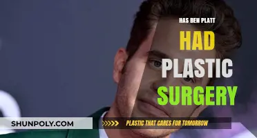 Ben Platt Plastic Surgery: Fact-Checking the Transformation Rumors