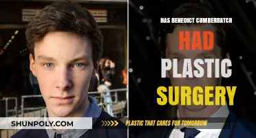 Has Benedict Cumberbatch Had Plastic Surgery? Unveiling the Truth