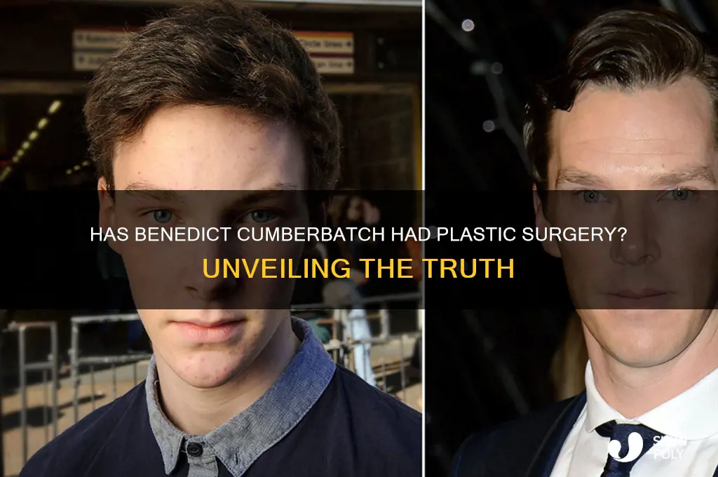 has benedict cumberbatch had plastic surgery