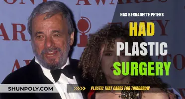 Bernadette Peters Plastic Surgery: Fact-Checking the Rumors and Speculations