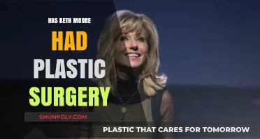 Beth Moore Plastic Surgery: Fact-Checking Rumors and Speculations