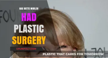 Bette Midler's Transformation: Plastic Surgery Speculations and Truths Revealed