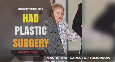 Betty White's Timeless Beauty: Plastic Surgery Rumors Explored