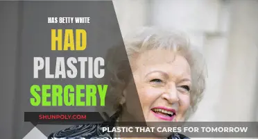 Betty White's Plastic Surgery: Fact or Fiction?