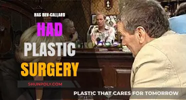 Bev Callard Plastic Surgery: Fact-Checking the Rumors and Speculations