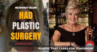 Beverley Callard's Transformation: Plastic Surgery Speculations and Truths