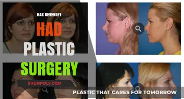 Beverley's Transformation: Plastic Surgery Speculations and the Truth Revealed