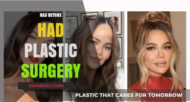 Has Beyoncé Undergone Plastic Surgery? Examining the Rumors and Facts