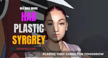 Plastic Surgery Speculation: Did Bhad Bhabie Go Under the Knife?