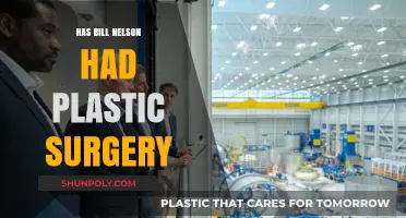Has Bill Nelson Had Plastic Surgery? Uncovering the Truth