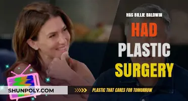 Billie Baldwin's Transformation: Plastic Surgery Rumors and Speculations