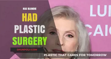 Has Blondie Had Plastic Surgery? Unveiling the Truth Behind Her Look