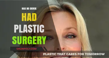 Bo Derek's Transformation: Plastic Surgery Rumors and Reality Revealed