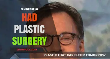 Bob Costas Plastic Surgery: Fact-Checking the Rumors and Speculations