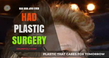 Has Bon Jovi Had Plastic Surgery? Uncovering the Truth