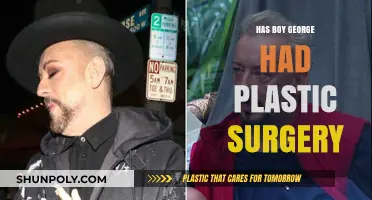 Boy George's Transformation: Plastic Surgery Rumors and Reality Revealed