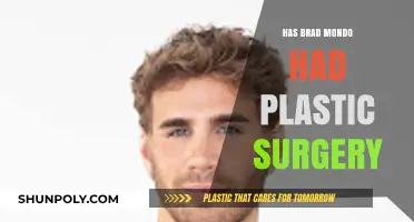 Brad Mondo Plastic Surgery: Fact-Checking the Rumors and Speculations