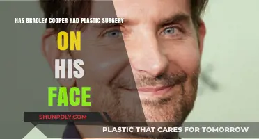 Bradley Cooper's Face: Natural Evolution or Plastic Surgery Transformation?