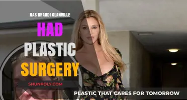 Brandi Glanville's Transformation: Plastic Surgery Rumors Explored