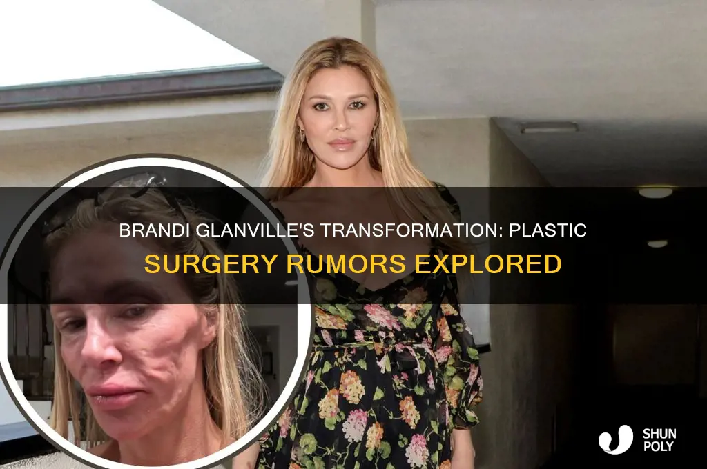 has brandi glanville had plastic surgery
