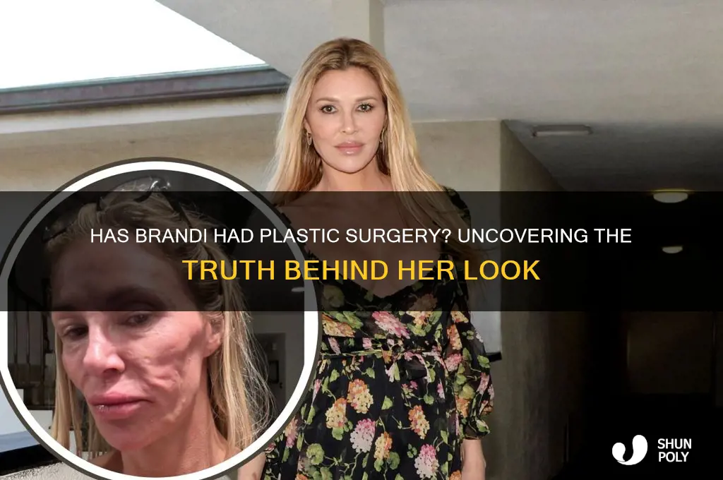 has brandi had plastic surgery