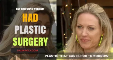 Braunwyn Windham's Transformation: Plastic Surgery Speculations and Truths