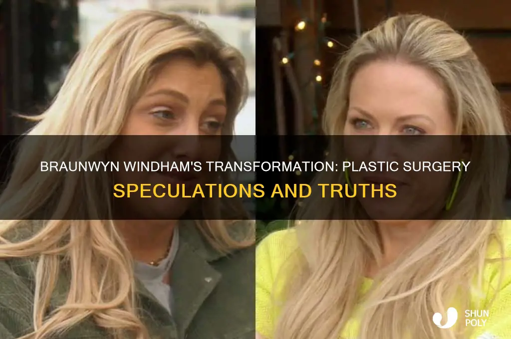 has braunwyn windham had plastic surgery