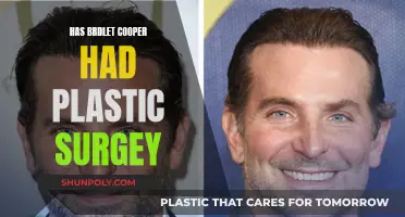 Bradley Cooper's Transformation: Plastic Surgery Speculation