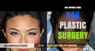 Brenda Song Plastic Surgery: Fact-Checking the Rumors and Speculations