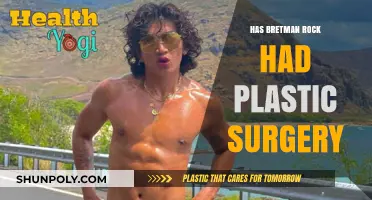 Bretman Rock's Transformation: Plastic Surgery Rumors Explored and Debunked