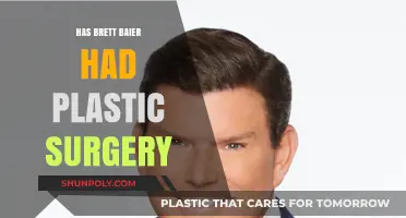 Brett Baier's Appearance: Plastic Surgery Speculations and Facts Revealed