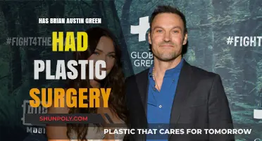 Brian Austin Green Plastic Surgery: Fact-Checking the Transformation Rumors