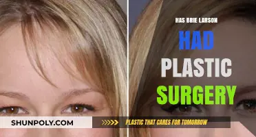 Brie Larson Plastic Surgery: Fact-Checking Rumors and Speculations