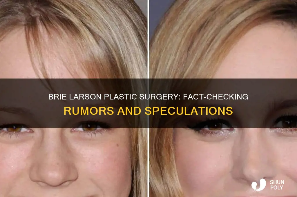 has brie larson had plastic surgery