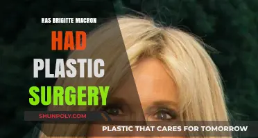 Brigitte Macron's Youthful Look: Plastic Surgery Speculations Explored