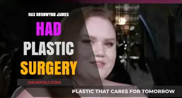 Has Bronwynn James Had Plastic Surgery? Unveiling the Truth