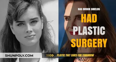 Has Brooke Shields Had Plastic Surgery? Unveiling the Truth