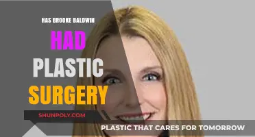 Brooke Baldwin's Transformation: Plastic Surgery Speculations and Truths